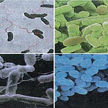 여러가지세균프레파라트/영구프레파라트/4종1조
